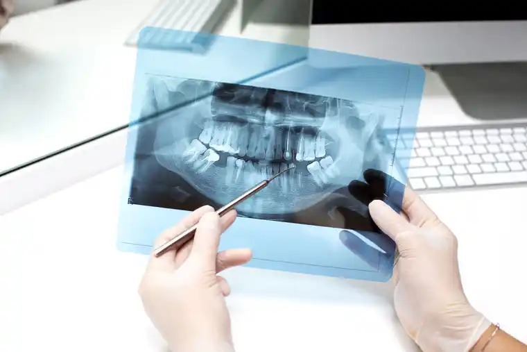 estudios de laboratorio dentales mexico